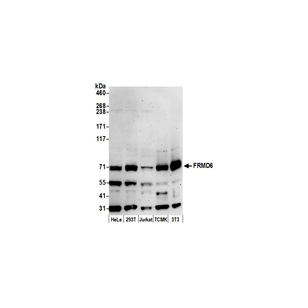 Rabbit anti-FRMD6 Antibody, Affinity Purified