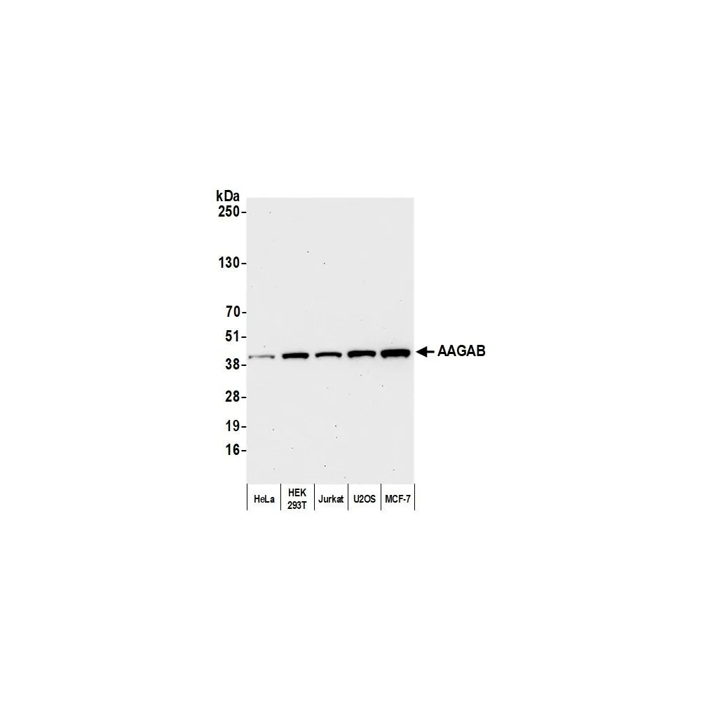 Rabbit anti-AAGAB Antibody, Affinity Purified