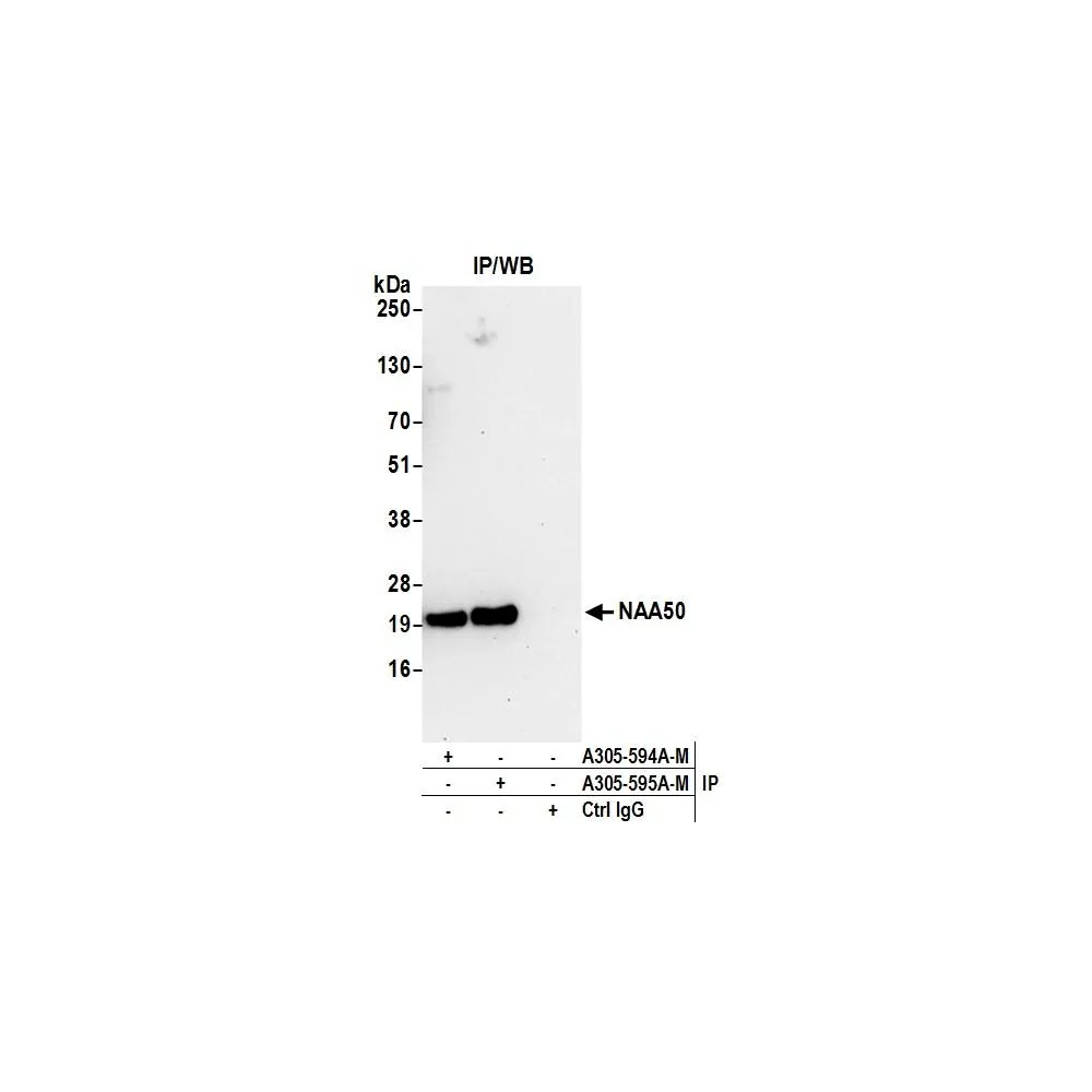Rabbit anti-NAA50 Antibody, Affinity Purified