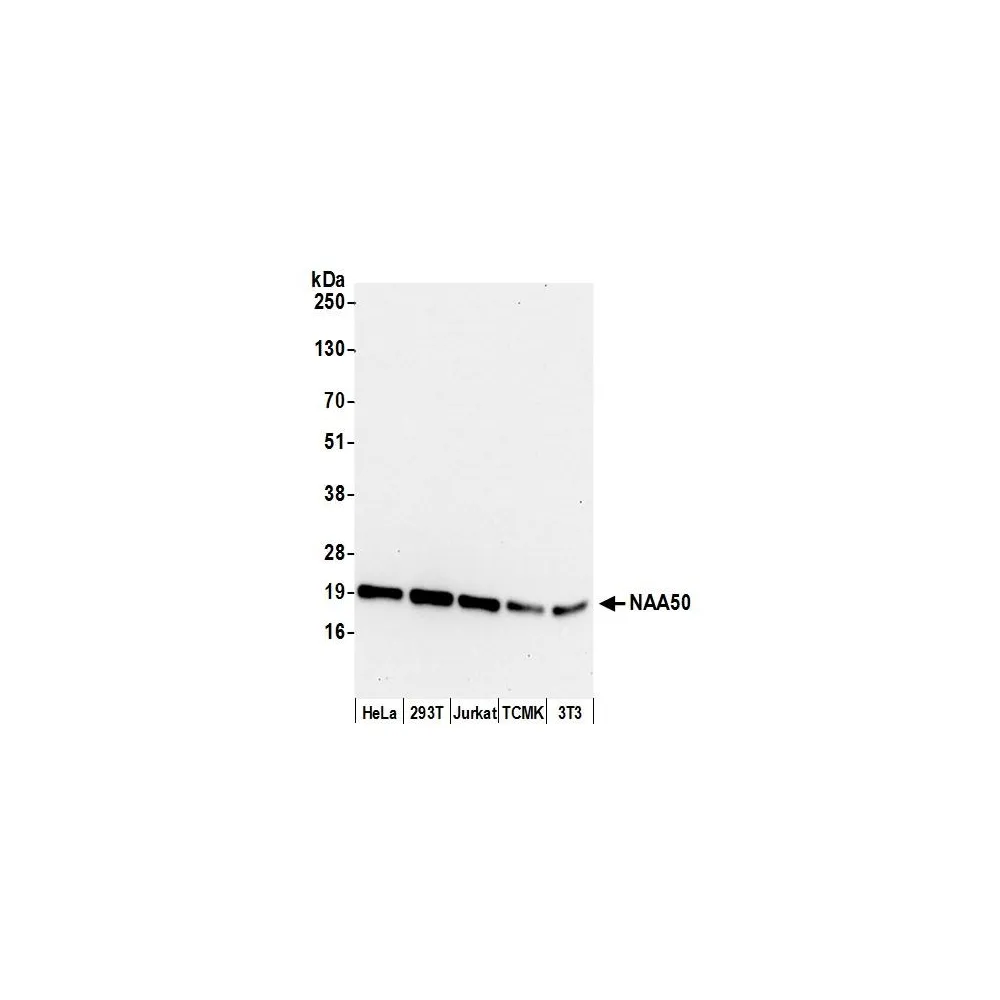 Rabbit anti-NAA50 Antibody, Affinity Purified
