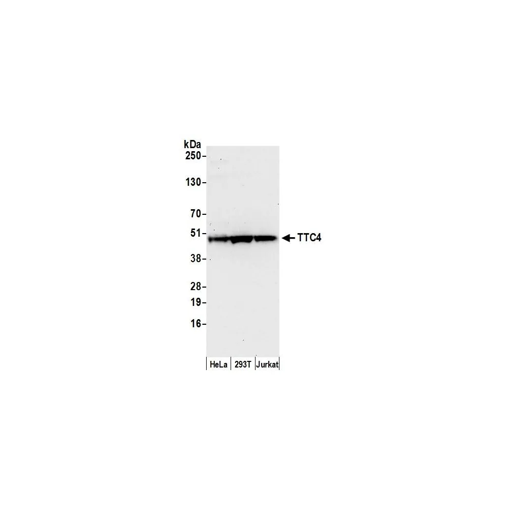 Rabbit anti-TTC4 Antibody, Affinity Purified