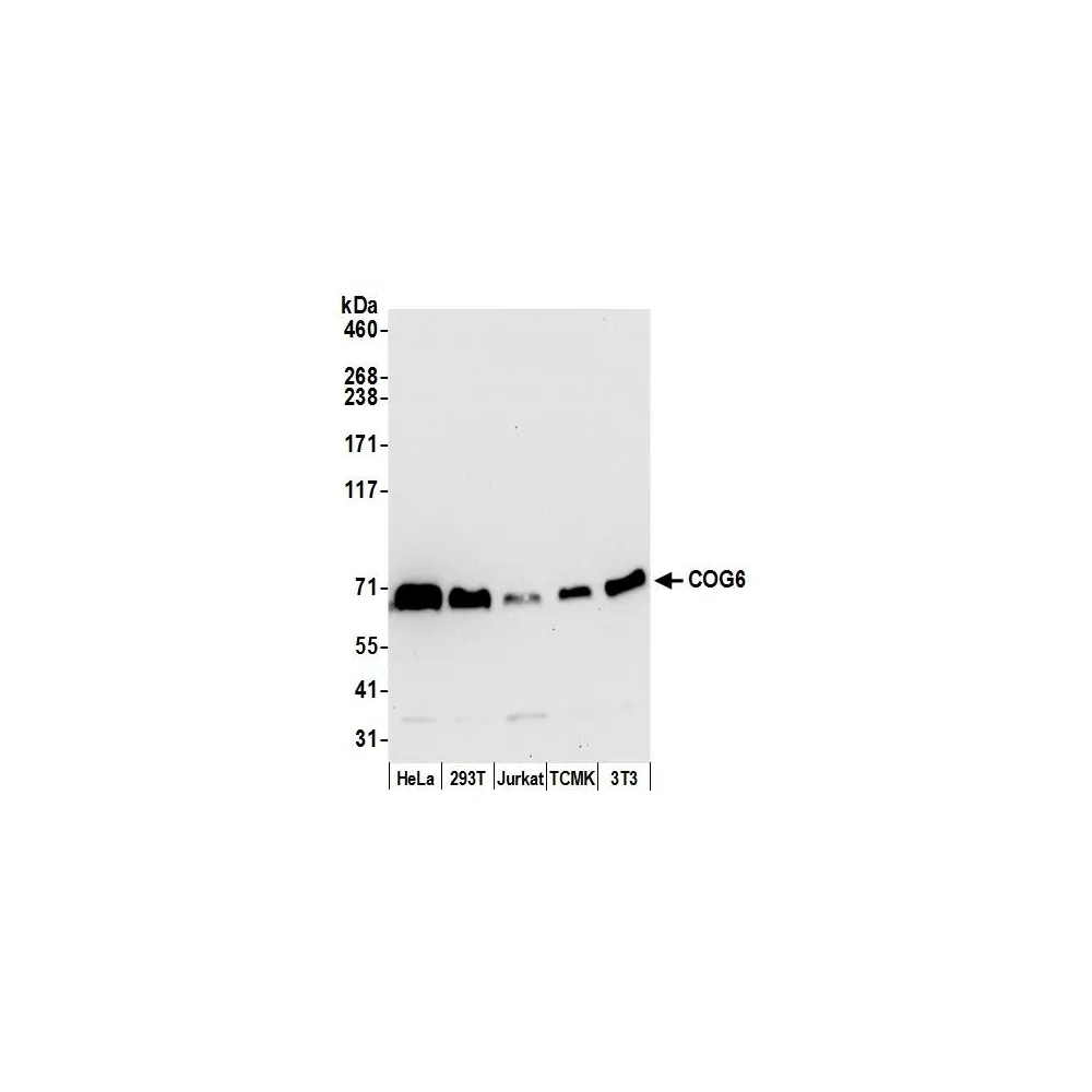 Rabbit anti-COG6 Antibody, Affinity Purified