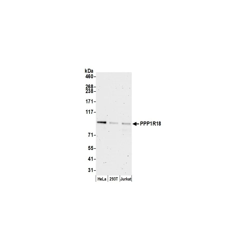Rabbit anti-PPP1R18 Antibody, Affinity Purified