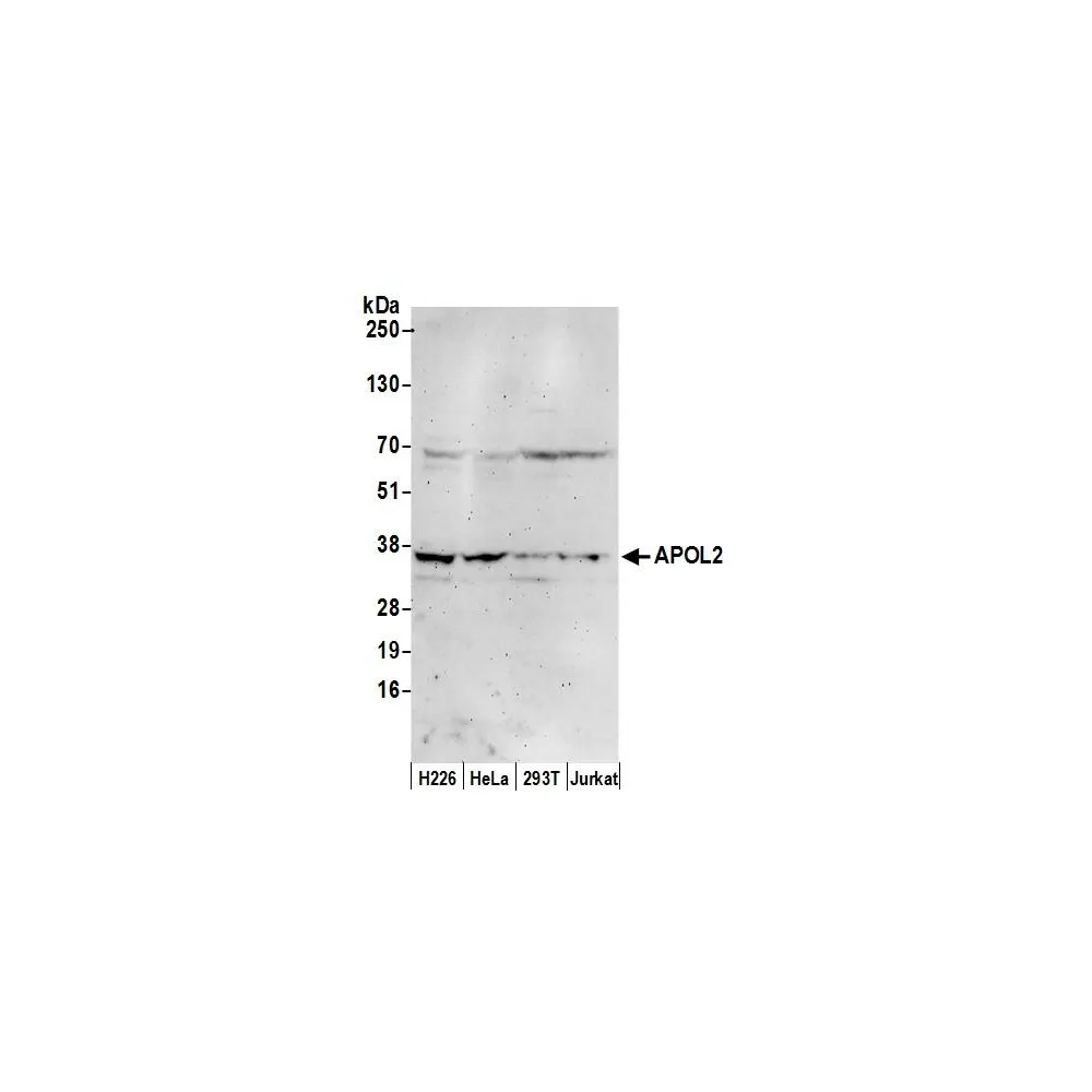 Rabbit anti-APOL2 Antibody, Affinity Purified