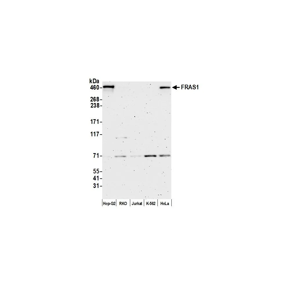 Rabbit anti-FRAS1 Antibody, Affinity Purified