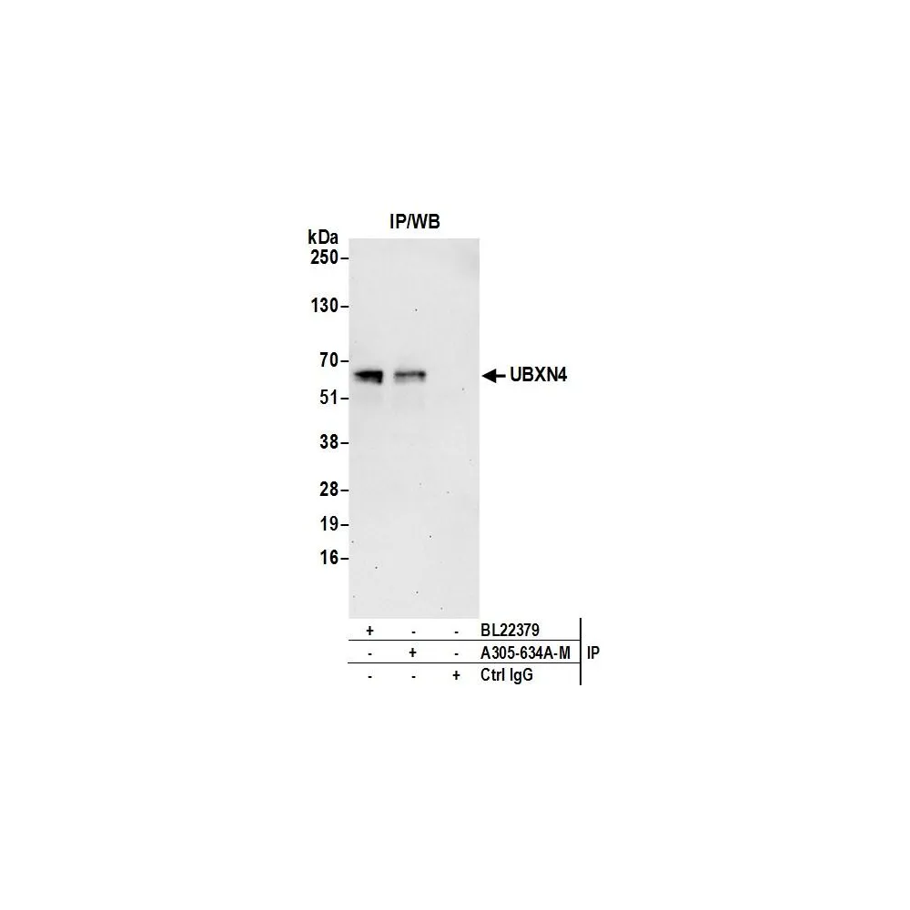 Rabbit anti-UBXN4 Antibody, Affinity Purified
