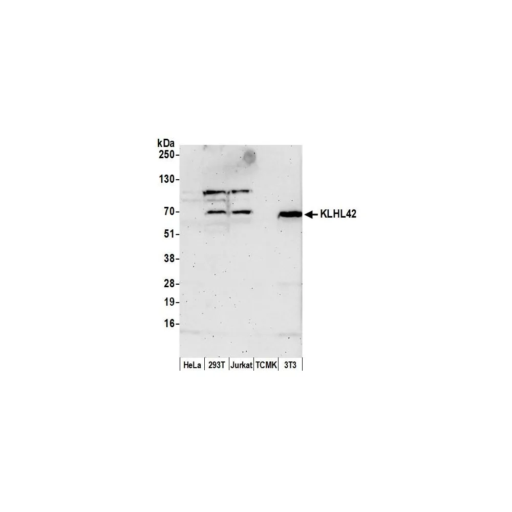Rabbit anti-KLHL42 Antibody, Affinity Purified