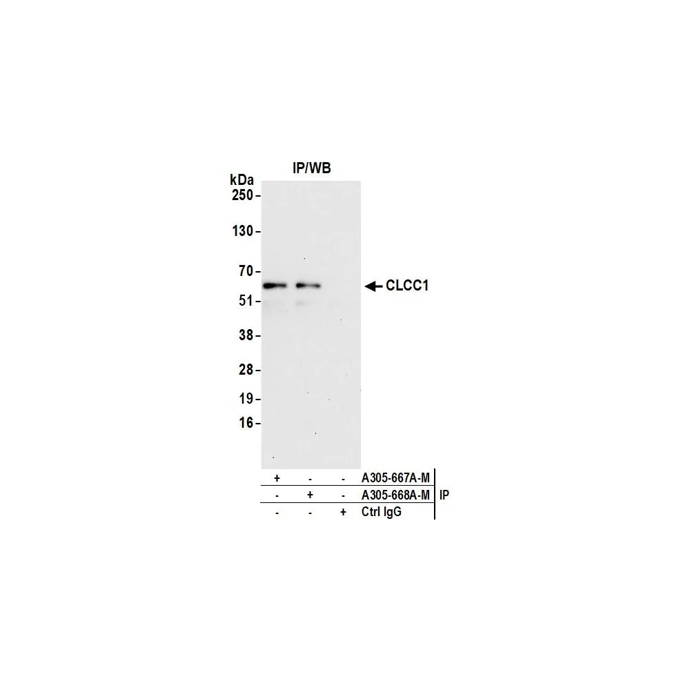 Rabbit anti-CLCC1 Antibody, Affinity Purified