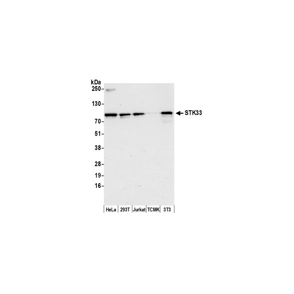 Rabbit anti-STK33 Antibody, Affinity Purified