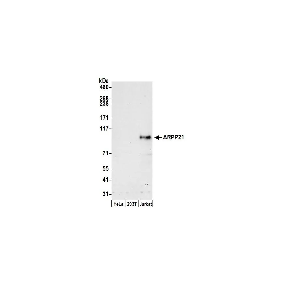 Rabbit anti-ARPP21 Antibody, Affinity Purified