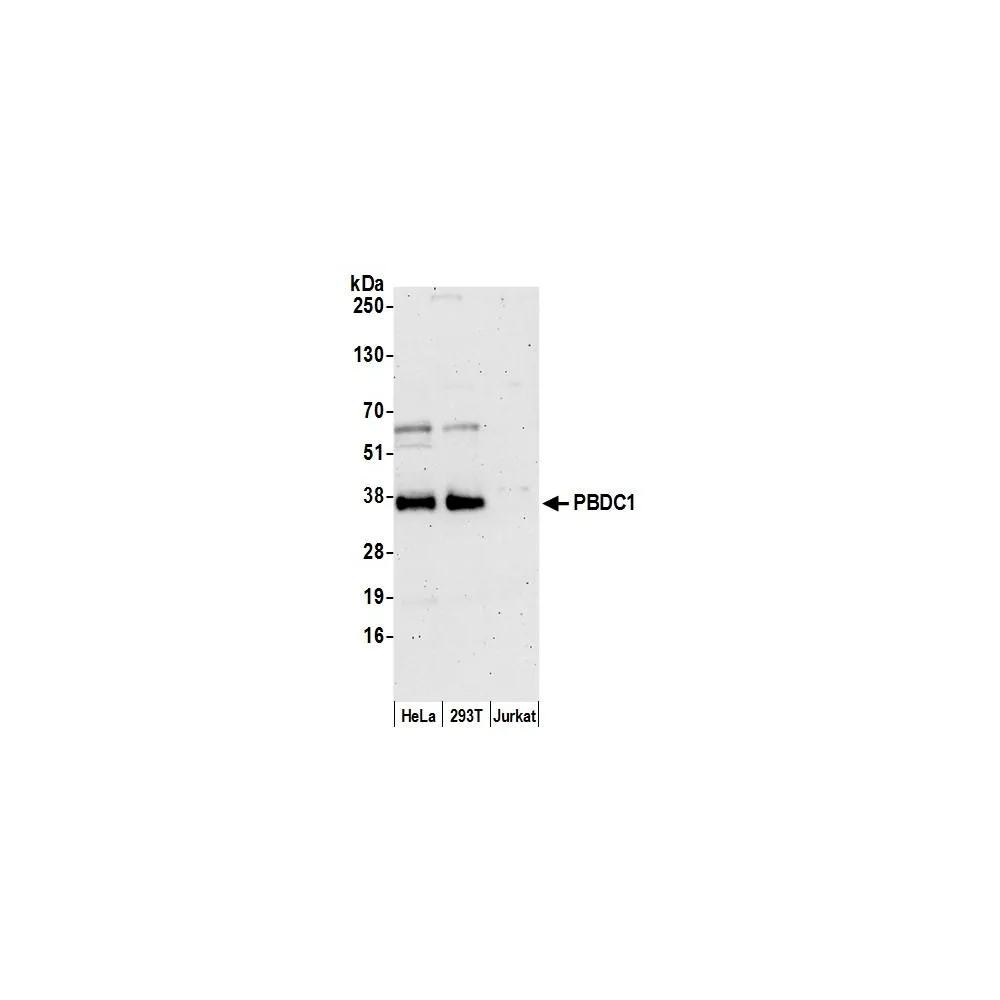 Rabbit anti-PBDC1 Antibody, Affinity Purified