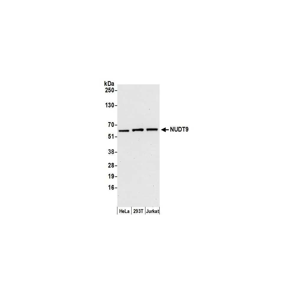Rabbit anti-NUDT9 Antibody, Affinity Purified