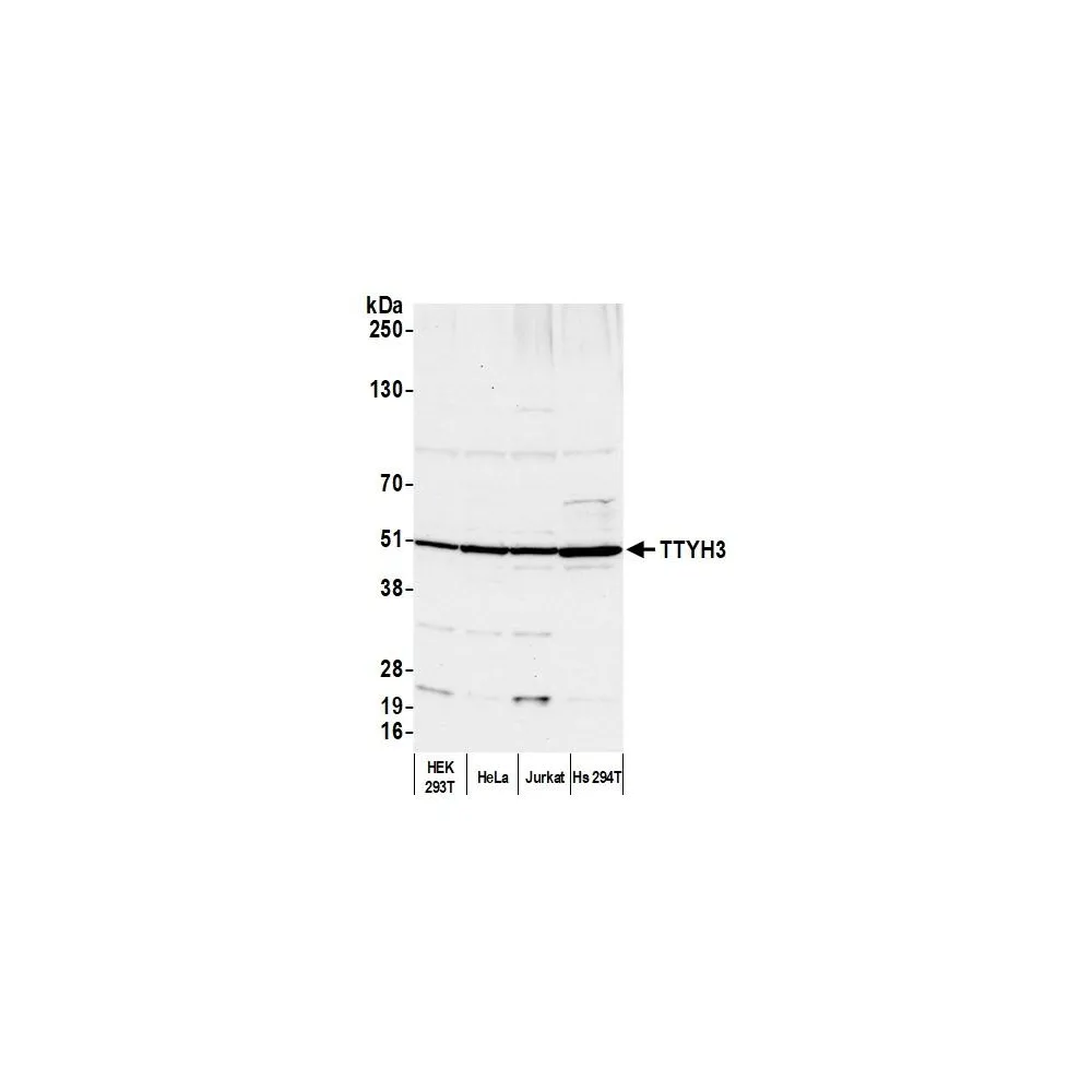 Rabbit anti-TTYH3 Antibody, Affinity Purified