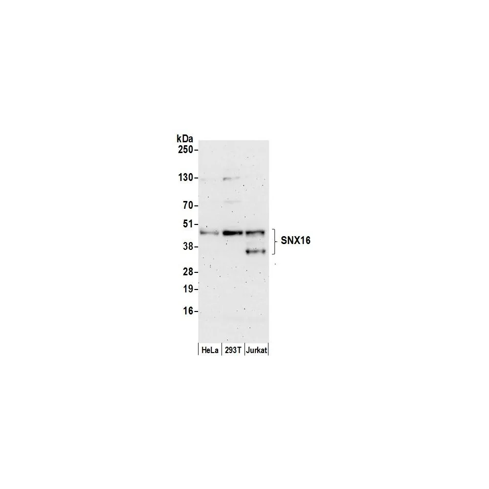 Rabbit anti-SNX16 Antibody, Affinity Purified