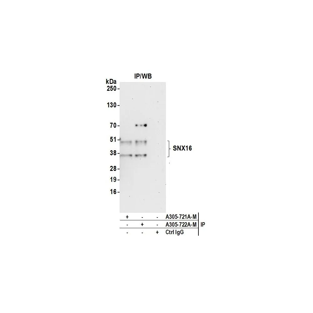 Rabbit anti-SNX16 Antibody, Affinity Purified