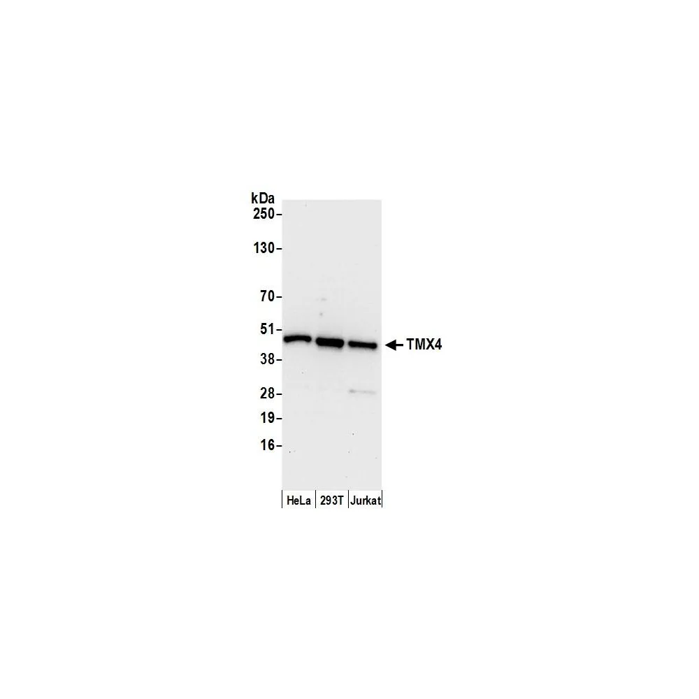 Rabbit anti-TMX4 Antibody, Affinity Purified