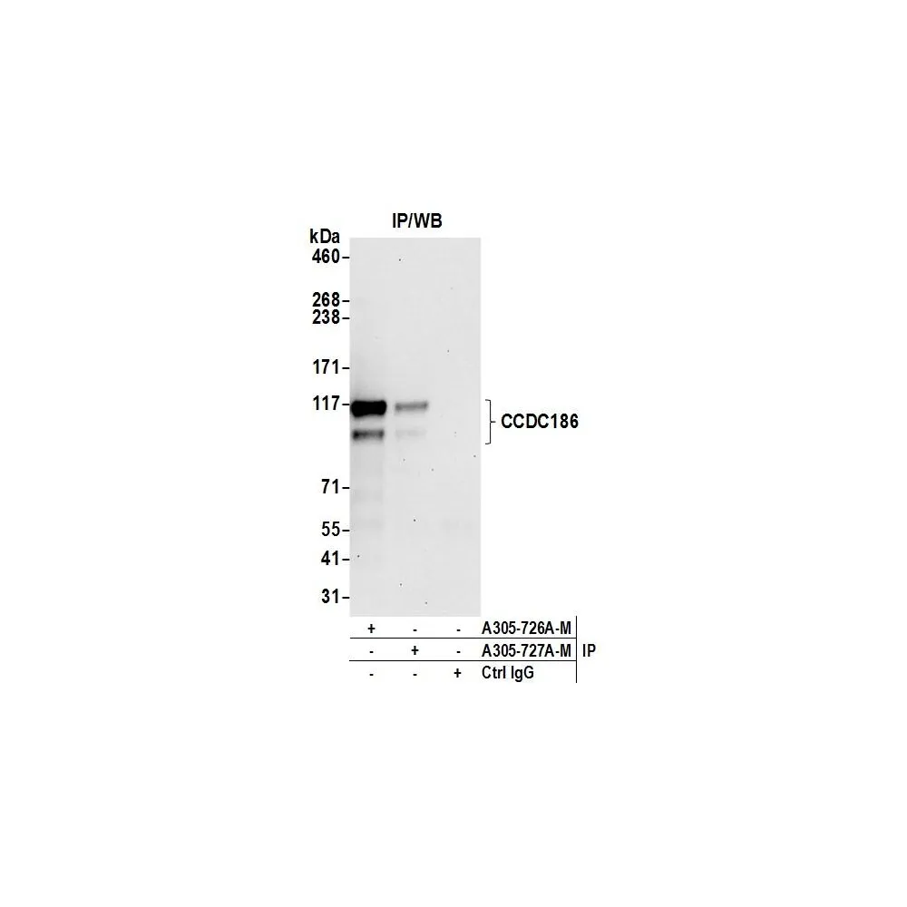 Rabbit anti-CCDC186 Antibody, Affinity Purified