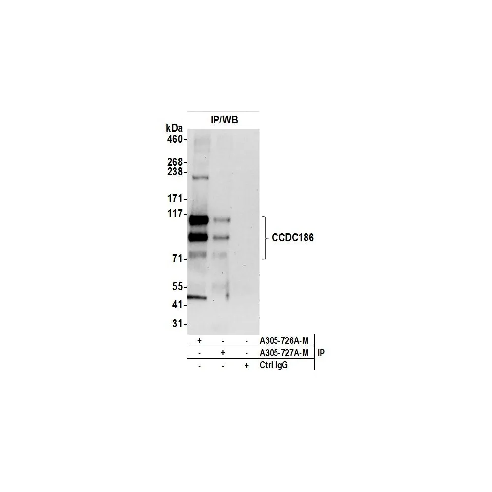 Rabbit anti-CCDC186 Antibody, Affinity Purified