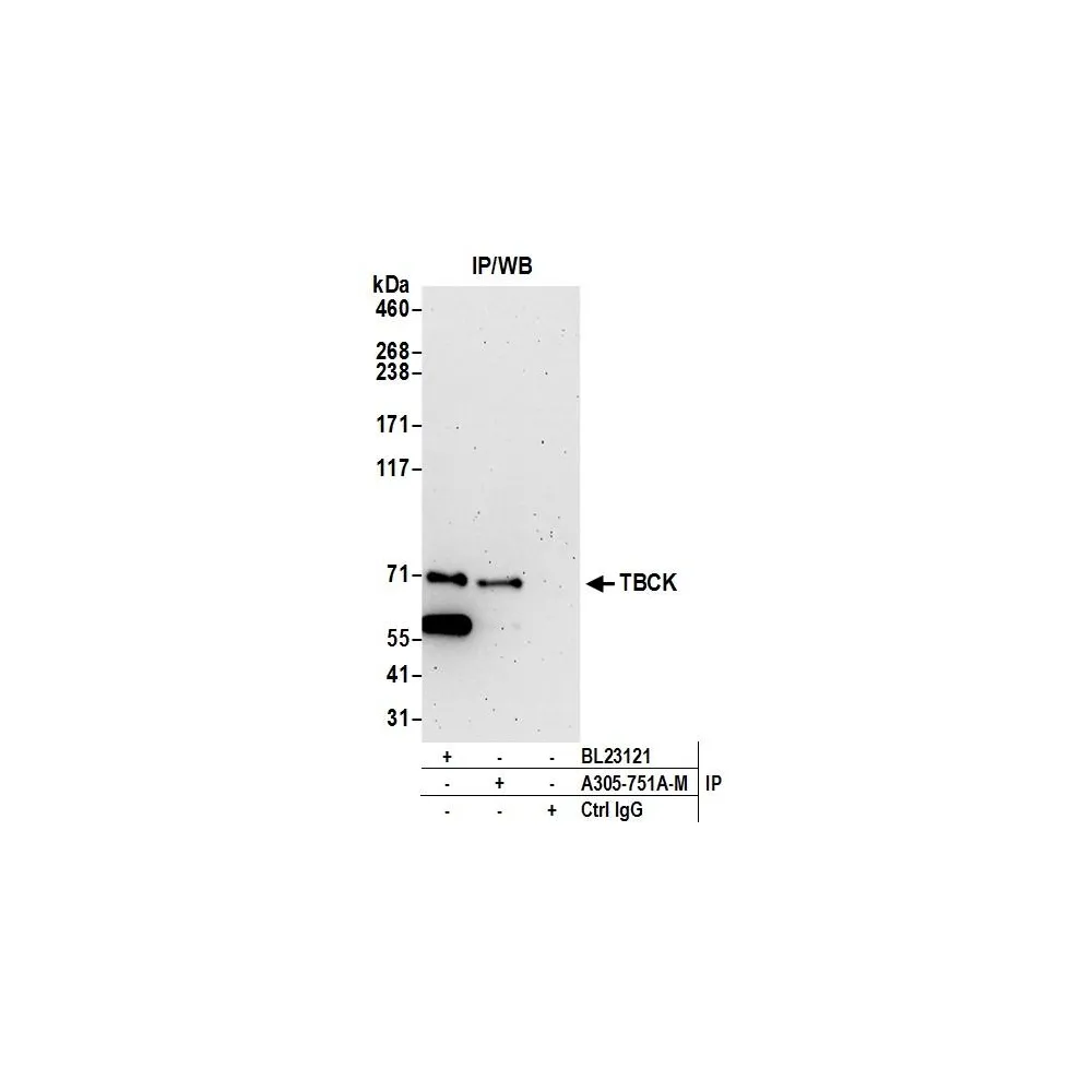 Rabbit anti-TBCK Antibody, Affinity Purified