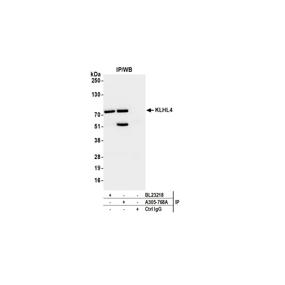 Rabbit anti-KLHL4 Antibody, Affinity Purified