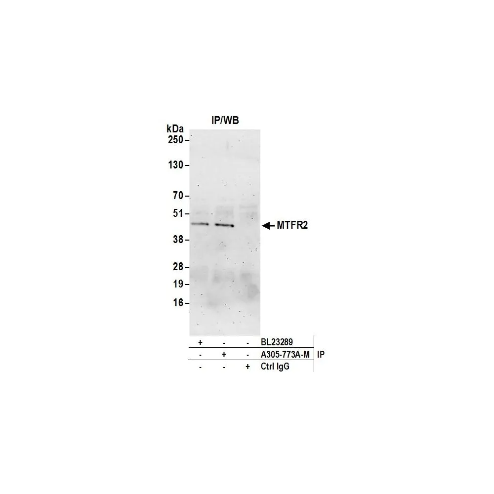 Rabbit anti-MTFR2 Antibody, Affinity Purified