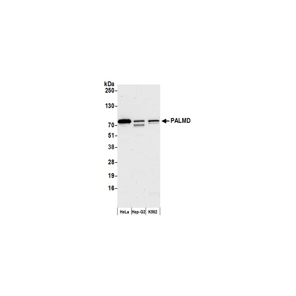 Rabbit anti-PALMD Antibody, Affinity Purified