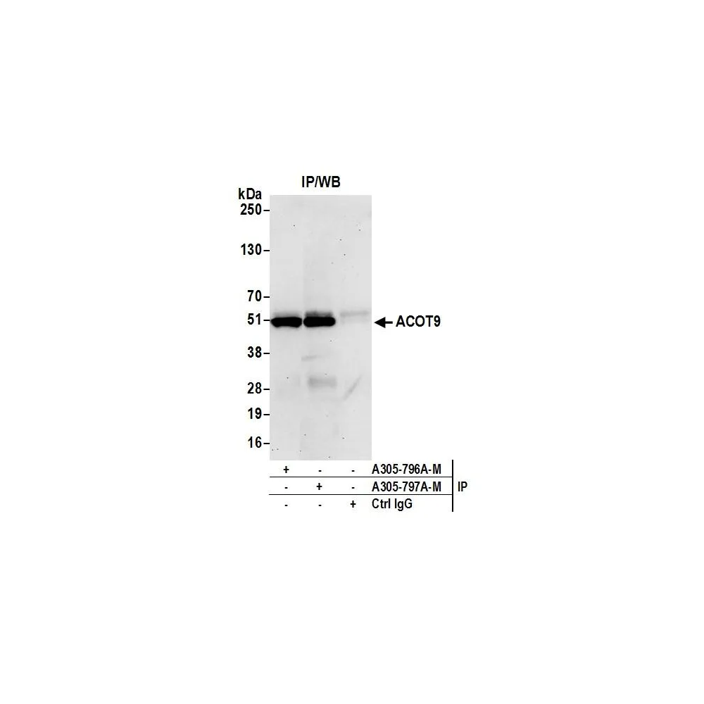 Rabbit anti-ACOT9 Antibody, Affinity Purified
