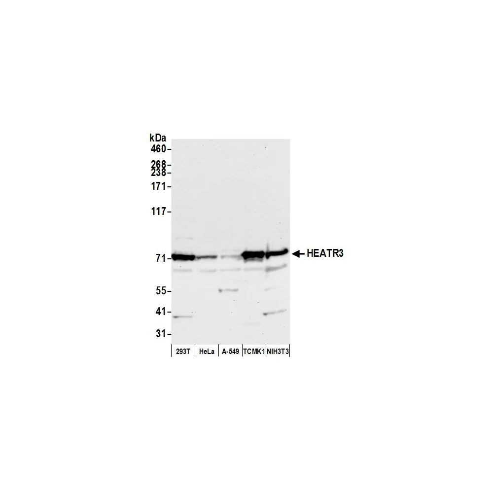 Rabbit anti-HEATR3 Antibody, Affinity Purified