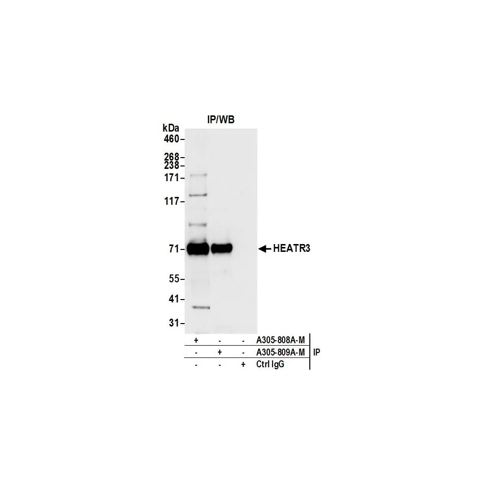 Rabbit anti-HEATR3 Antibody, Affinity Purified
