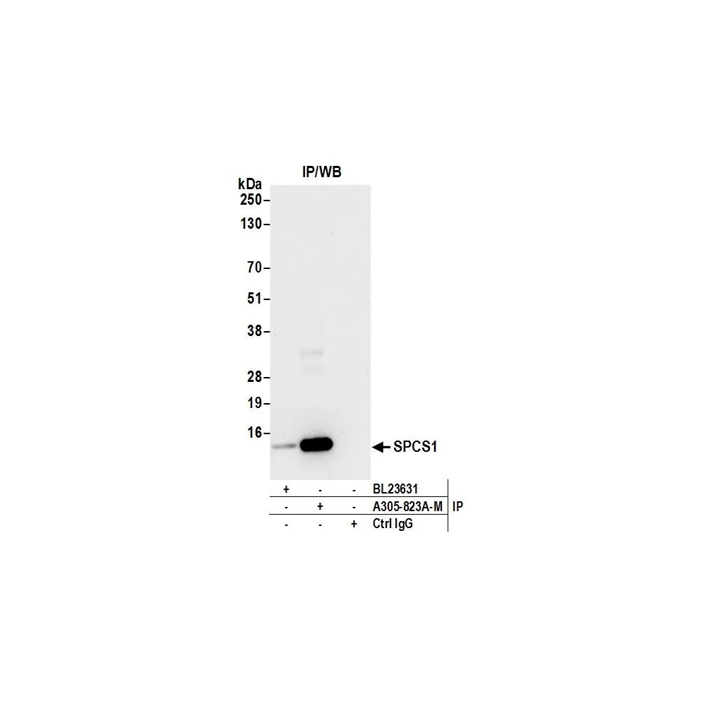 Rabbit anti-SPCS1 Antibody, Affinity Purified
