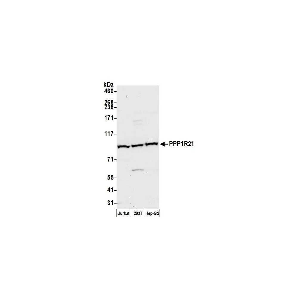 Rabbit anti-PPP1R21 Antibody, Affinity Purified