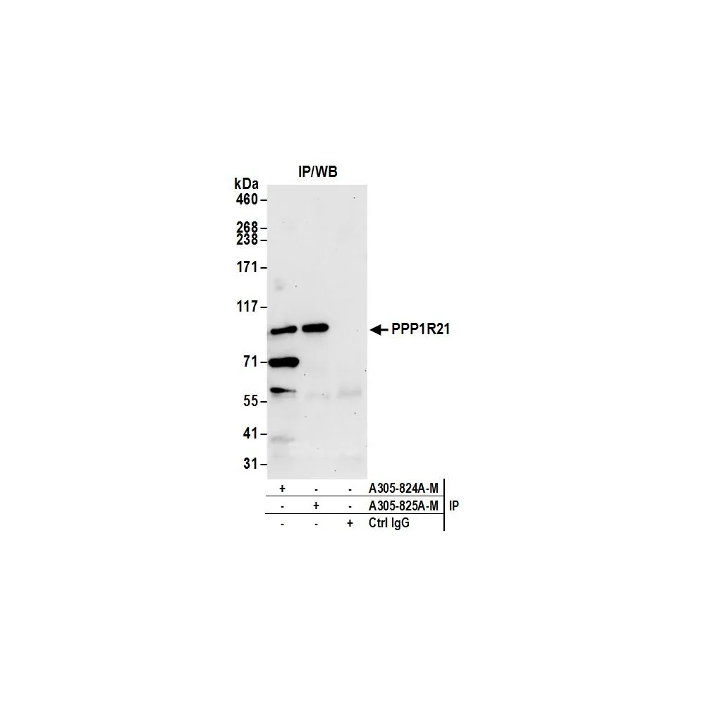 Rabbit anti-PPP1R21 Antibody, Affinity Purified