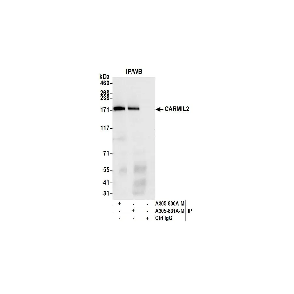 Rabbit anti-CARMIL2 Antibody, Affinity Purified