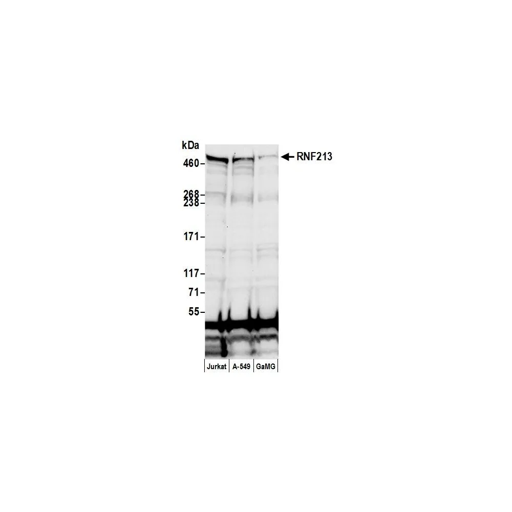 Rabbit anti-RNF213 Antibody, Affinity Purified