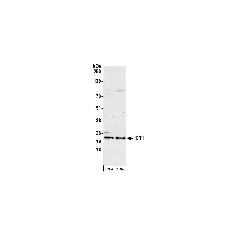 Rabbit anti-ICT1 Antibody, Affinity Purified