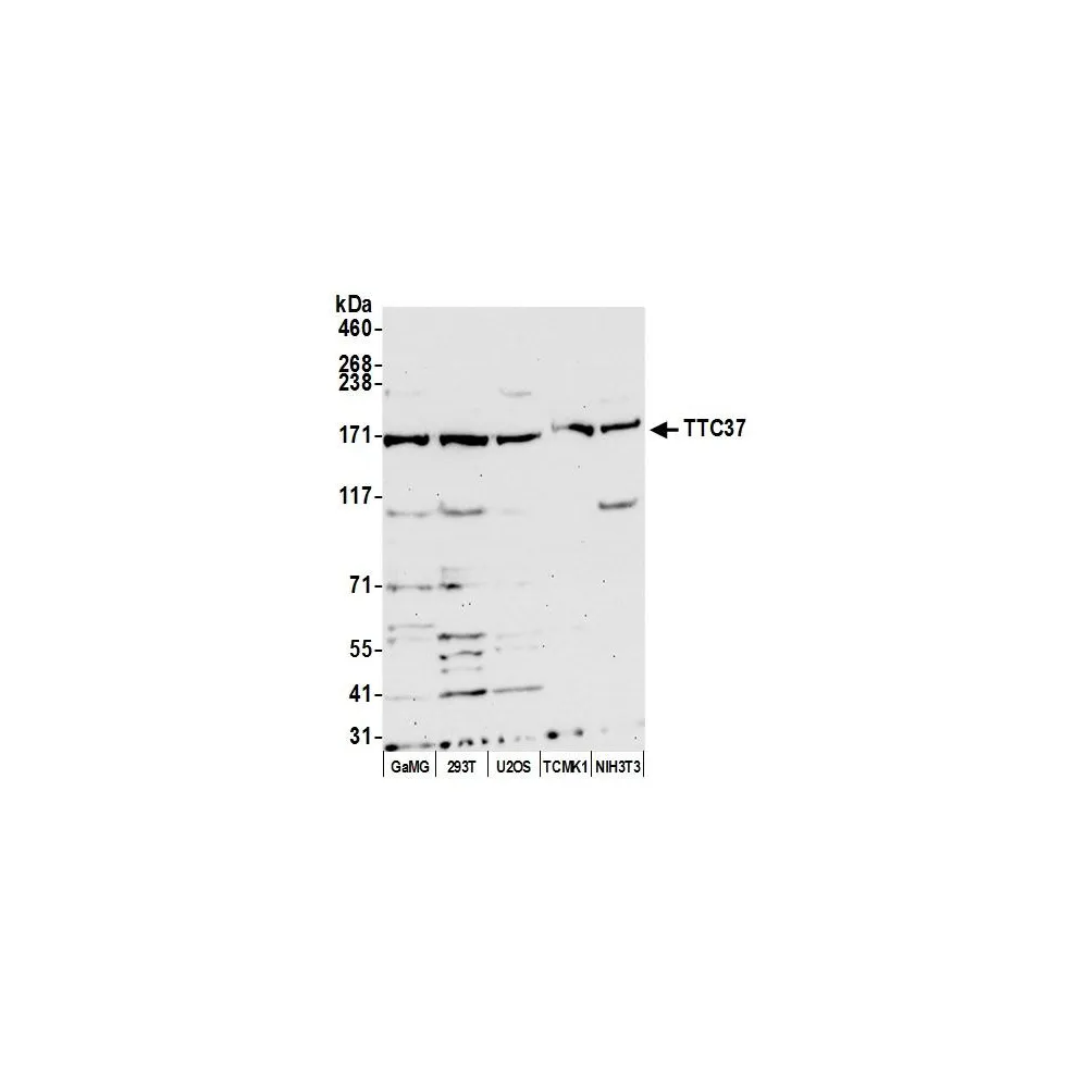 Rabbit anti-TTC37 Antibody, Affinity Purified