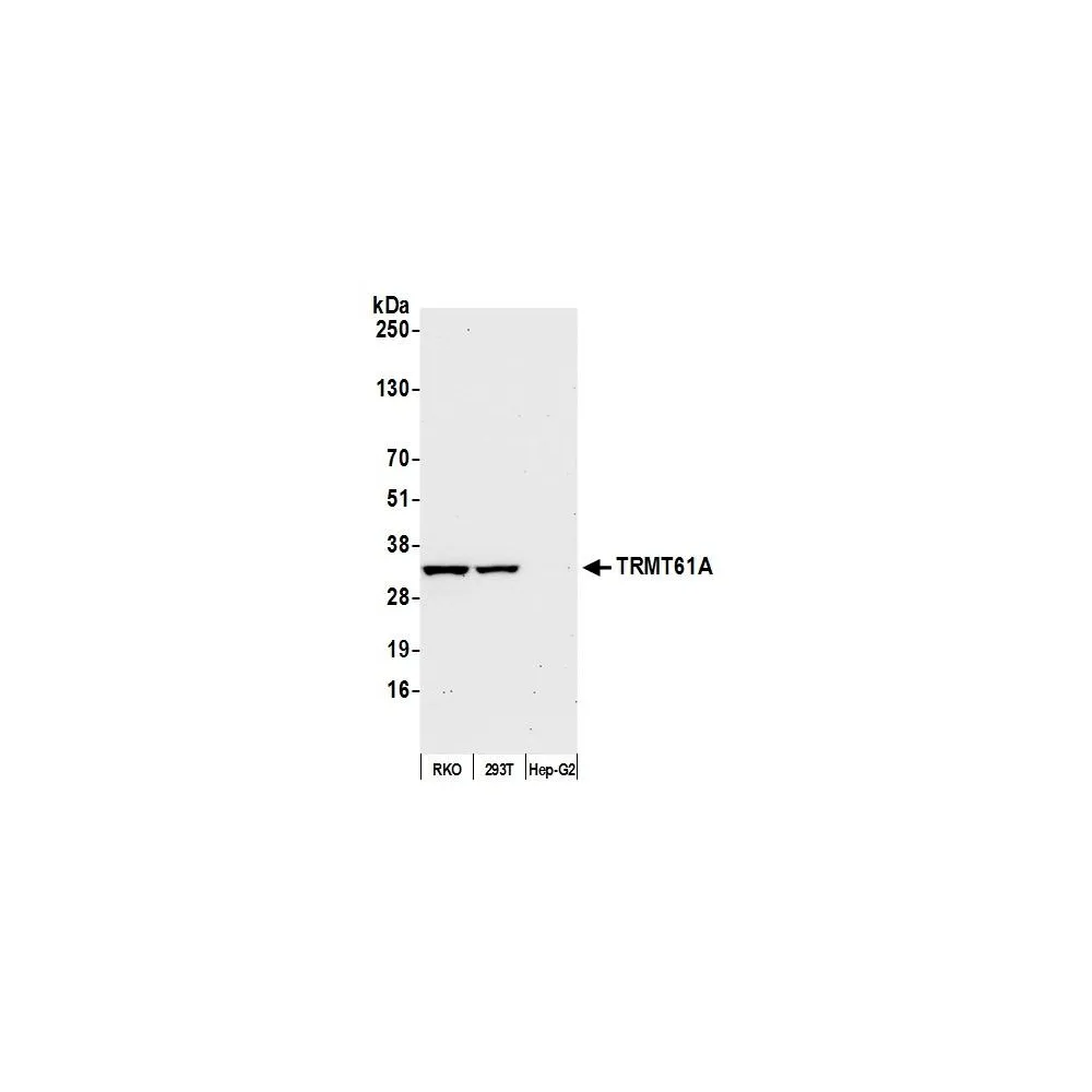 Rabbit anti-TRMT61A Antibody, Affinity Purified