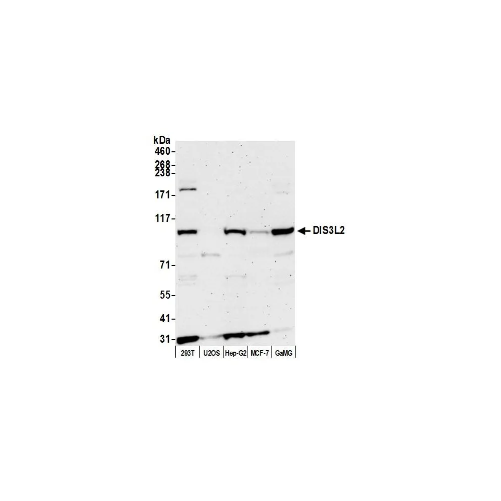 Rabbit anti-DIS3L2 Antibody, Affinity Purified