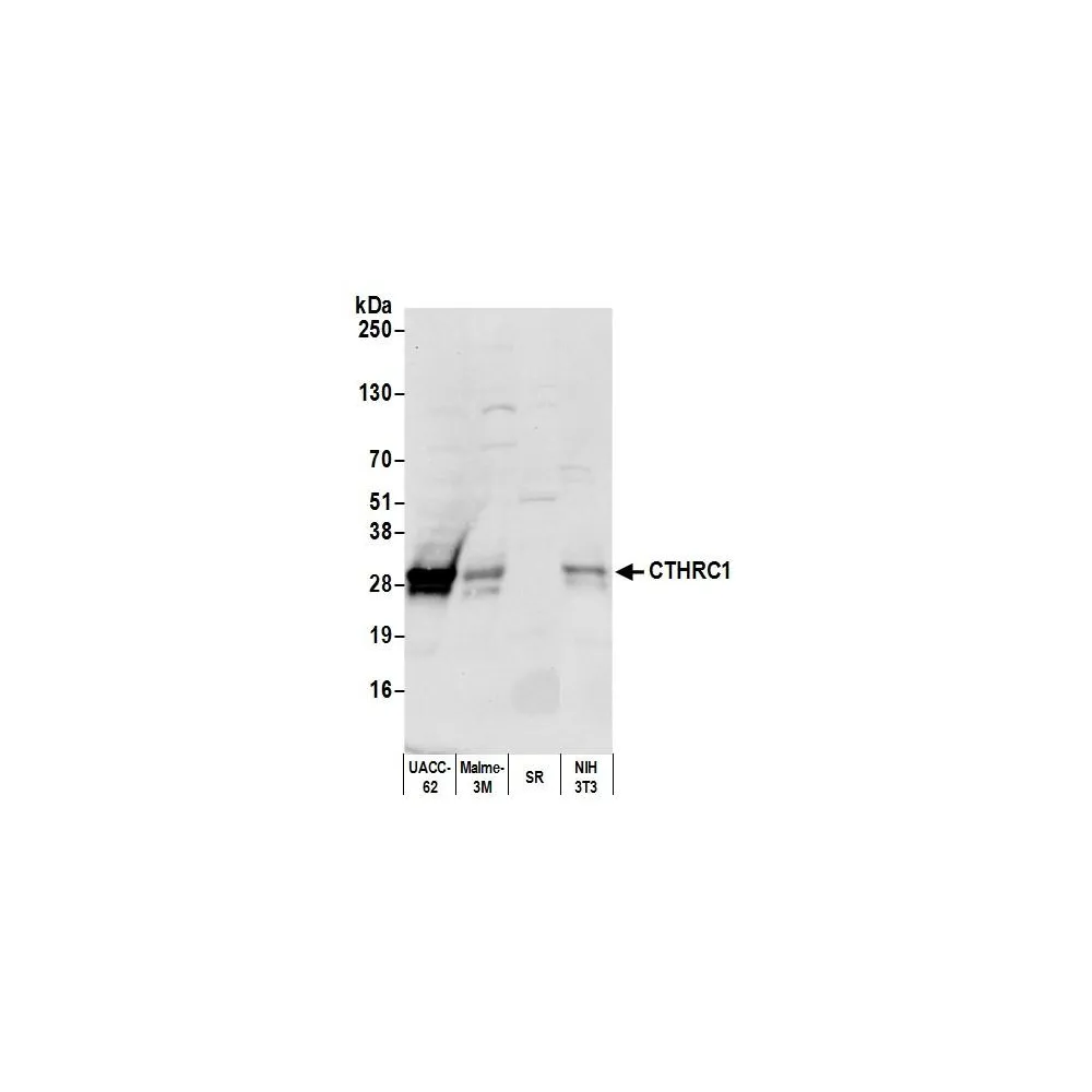 Rabbit anti-CTHRC1 Antibody, Affinity Purified