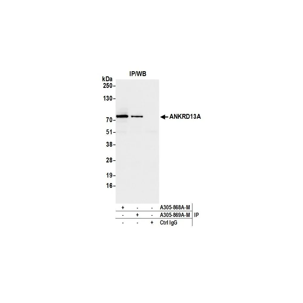 Rabbit anti-ANKRD13A Antibody, Affinity Purified