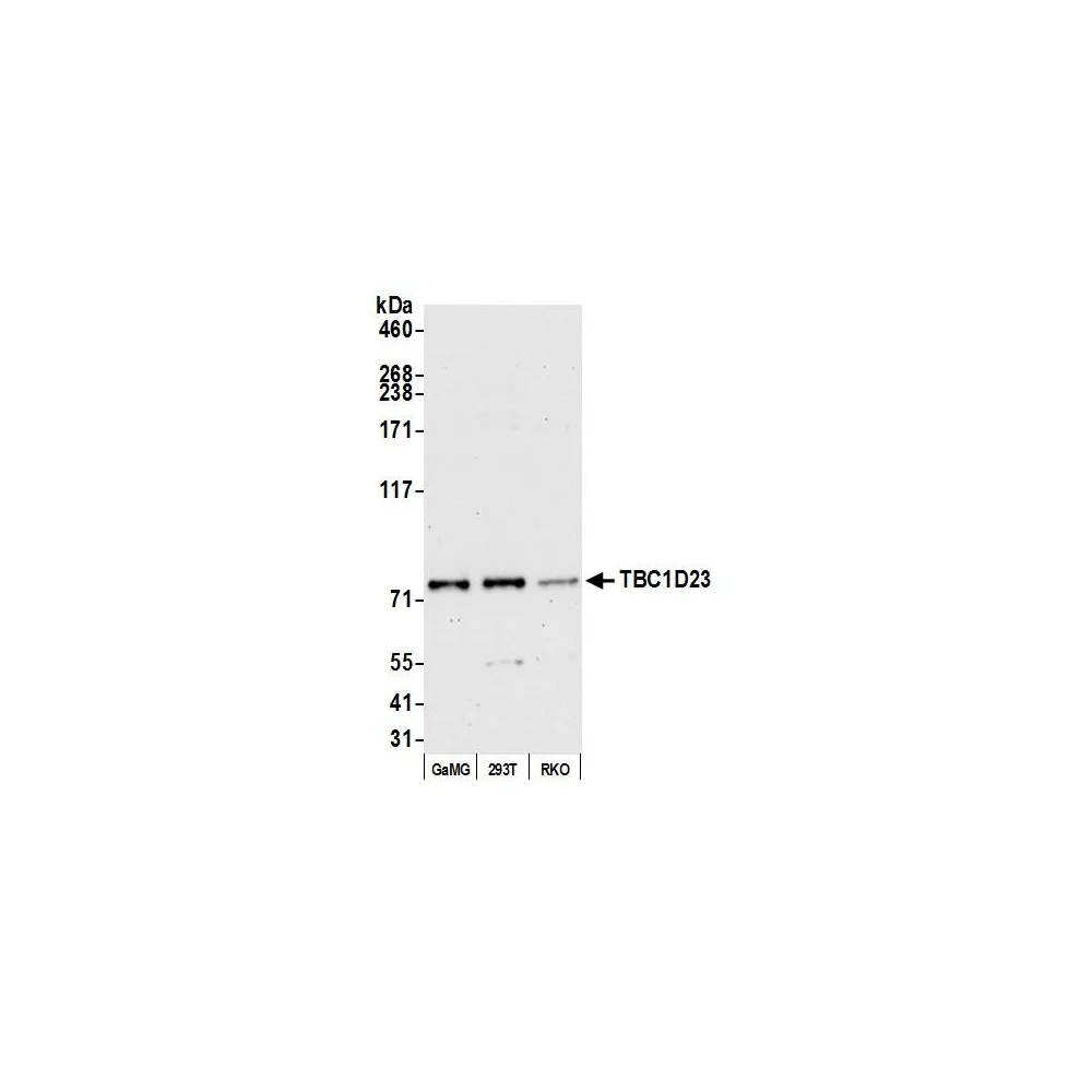 Rabbit anti-TBC1D23 Antibody, Affinity Purified