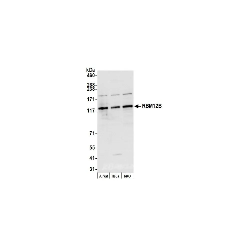 Rabbit anti-RBM12B Antibody, Affinity Purified