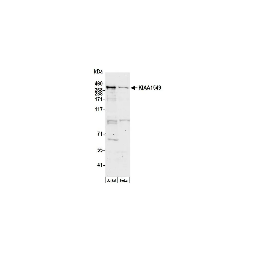 Rabbit anti-KIAA1549 Antibody, Affinity Purified