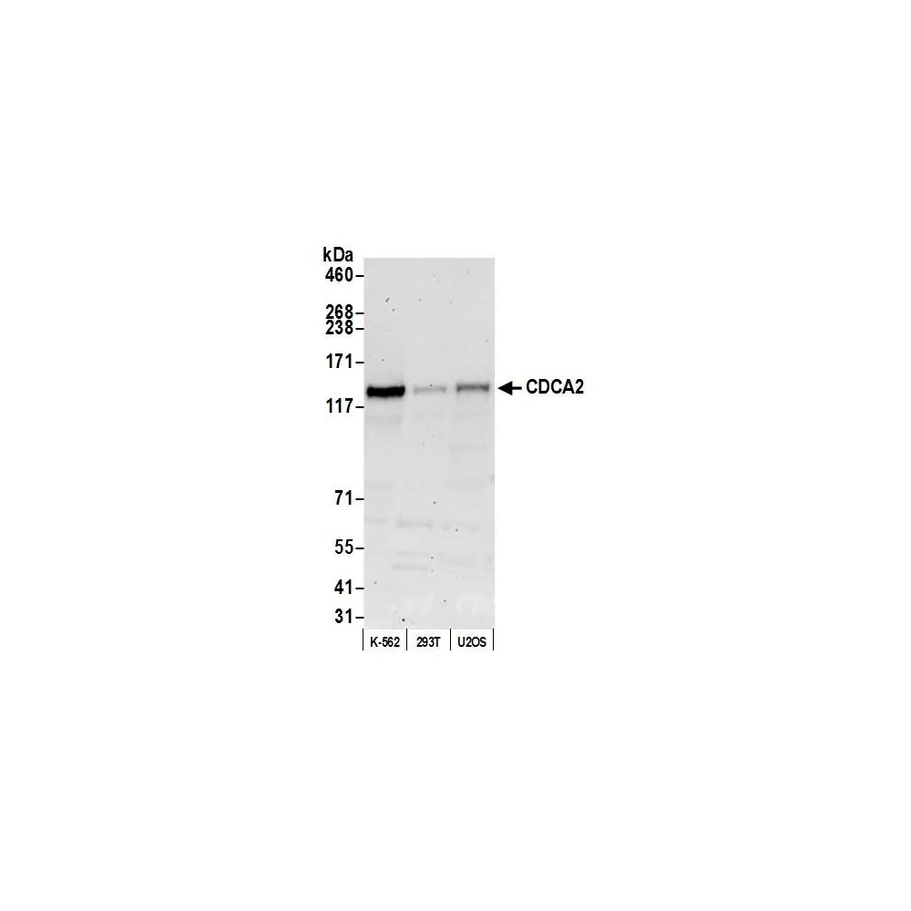 Rabbit anti-CDCA2 Antibody, Affinity Purified