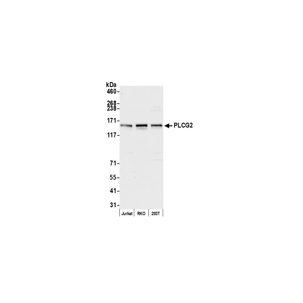 Rabbit anti-PLCG2 Antibody, Affinity Purified