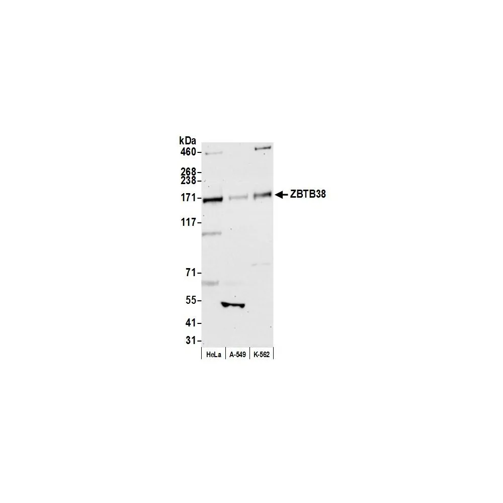 Rabbit anti-ZBTB38 Antibody, Affinity Purified