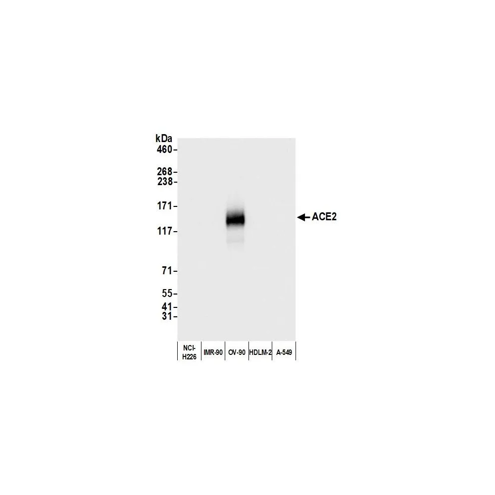 Rabbit anti-ACE2 Antibody, Affinity Purified