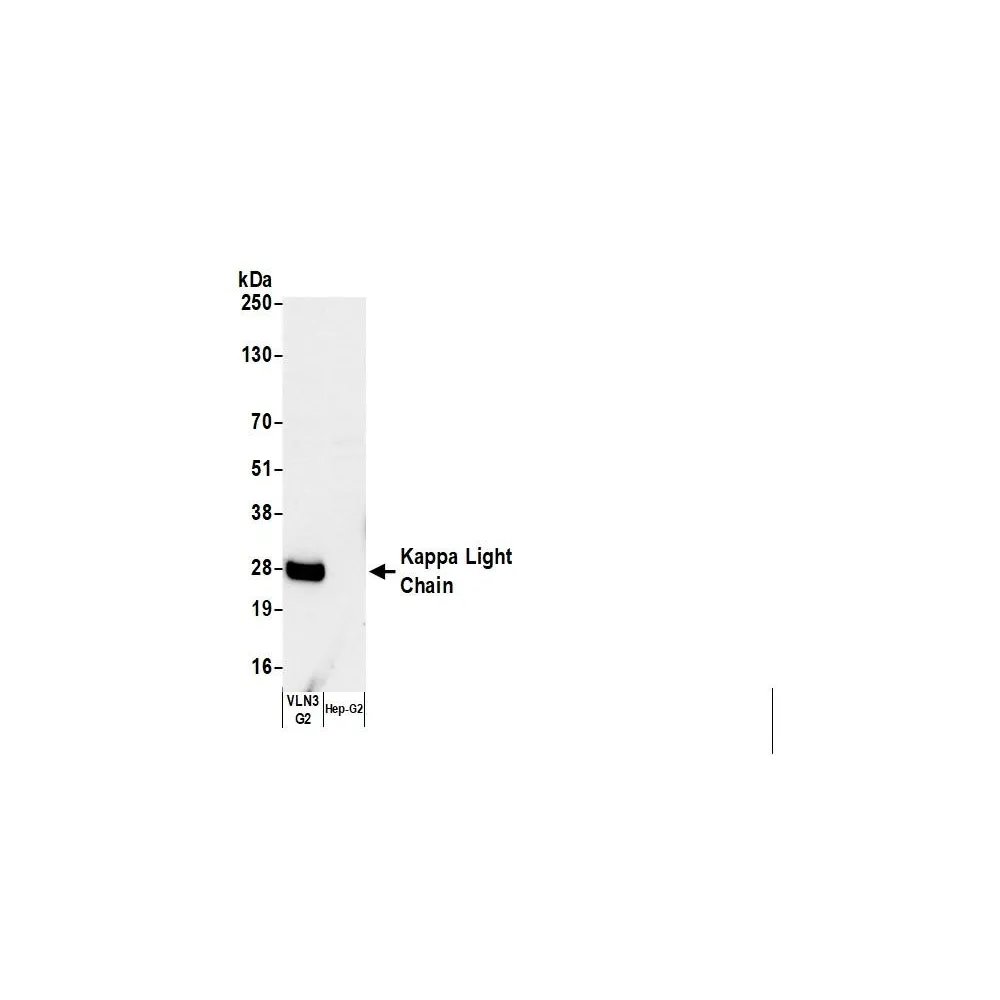 Rabbit anti-Human Kappa Light Chain Antibody