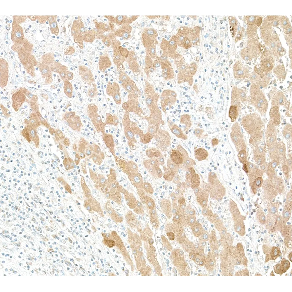 Goat anti-Human C-Reactive Protein (CRP) Antibody FITC Conjugated