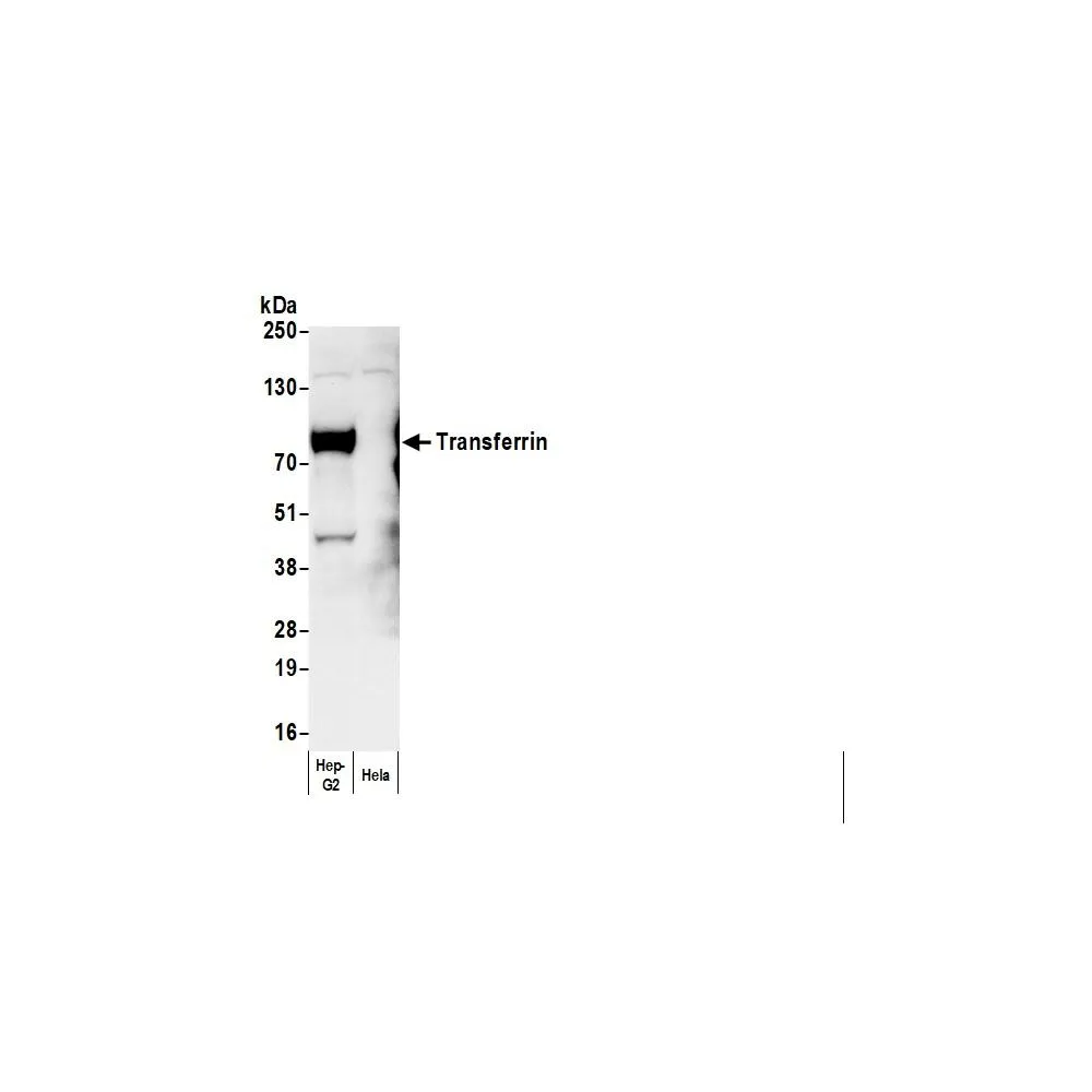 Goat anti-Human Transferrin Antibody HRP Conjugated